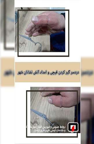 عملیات رها سازی در پی گیر کردن قیچی در دست شهروند /آتش نشانی رشت